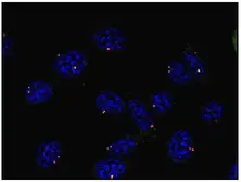 Anti-gamma Tubulin antibody [TU-30] used in Immunocytochemistry/ Immunofluorescence (ICC/IF). GTX79861
