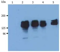 Anti-SHIP1 antibody [SHIP-02] used in Western Blot (WB). GTX79893
