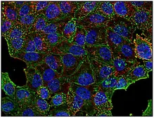 Anti-Clathrin Heavy chain antibody [BF-06] used in Immunocytochemistry/ Immunofluorescence (ICC/IF). GTX80218