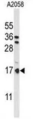 Anti-PTMS antibody, C-term used in Western Blot (WB). GTX80442
