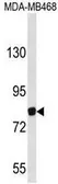 Anti-EVI5 antibody, Internal used in Western Blot (WB). GTX80518