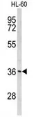 Anti-PEX14 antibody, C-term used in Western Blot (WB). GTX80530