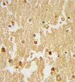 Anti-ERR beta antibody, Internal used in IHC (Paraffin sections) (IHC-P). GTX80586