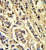 Anti-VEGF Receptor 2 antibody used in IHC (Paraffin sections) (IHC-P). GTX80591