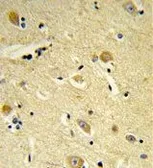 Anti-CDIPT antibody, Internal used in IHC (Paraffin sections) (IHC-P). GTX80599