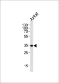 Anti-CD32a antibody, C-term used in Western Blot (WB). GTX80944