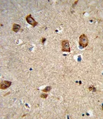 Anti-Integrin alpha 1 antibody, Internal used in IHC (Paraffin sections) (IHC-P). GTX81008