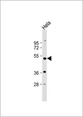 Anti-PXR antibody, Internal used in Western Blot (WB). GTX81102