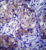 Anti-CYP1A1 antibody, Internal used in IHC (Paraffin sections) (IHC-P). GTX81231