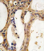 Anti-PIM1 antibody used in IHC (Paraffin sections) (IHC-P). GTX81239