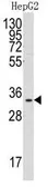 Anti-C1qBP antibody, Internal used in Western Blot (WB). GTX81280