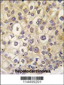 Anti-Rho 8 antibody, Internal used in IHC (Paraffin sections) (IHC-P). GTX81316
