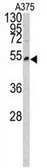 Anti-LUM antibody, Internal used in Western Blot (WB). GTX81362