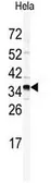 Anti-GOLPH3 antibody, N-term used in Western Blot (WB). GTX81443