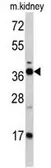 Anti-FBP1 antibody, Internal used in Western Blot (WB). GTX81482
