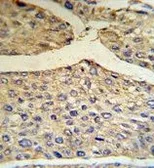 Anti-Factor B (Bb fragment) antibody, Internal used in IHC (Paraffin sections) (IHC-P). GTX81508