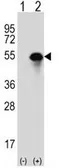 Anti-Carbonic Anhydrase 14 antibody, N-term used in Western Blot (WB). GTX81537