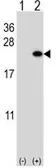 Anti-BarX1 antibody, C-term used in Western Blot (WB). GTX81557