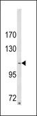Anti-ARGBP2 antibody, N-term used in Western Blot (WB). GTX81600