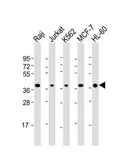 Anti-CD62L antibody, C-term used in Western Blot (WB). GTX81602