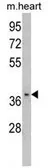 Anti-FBP2 antibody, C-term used in Western Blot (WB). GTX81753