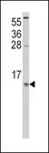 Anti-MCP1 / CCL2 antibody, C-term used in Western Blot (WB). GTX81767