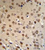 Anti-WTX antibody, Internal used in IHC (Paraffin sections) (IHC-P). GTX81847