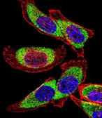 Anti-YB1 antibody, C-term used in Immunocytochemistry/ Immunofluorescence (ICC/IF). GTX81909