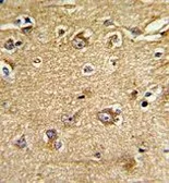 Anti-Mitofilin antibody, Internal used in IHC (Paraffin sections) (IHC-P). GTX81949