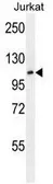 Anti-FBXL11 antibody, Internal used in Western Blot (WB). GTX82550
