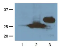 Anti-RFP antibody [RF5R] used in Western Blot (WB). GTX82561