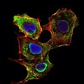 Anti-SMAD3 antibody [5G11] used in Immunocytochemistry/ Immunofluorescence (ICC/IF). GTX82809