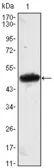 Anti-MESP1 antibody [1A3] used in Western Blot (WB). GTX82826