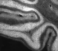 Anti-IP3 Receptor II antibody used in IHC (Frozen sections) (IHC-Fr). GTX82888