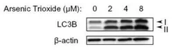 Anti-LC3B antibody used in Western Blot (WB). GTX82986