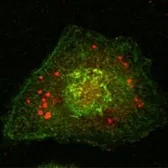 Anti-Calnexin antibody [3H4A7] used in Immunocytochemistry/ Immunofluorescence (ICC/IF). GTX83045