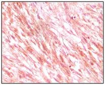 Anti-c-Kit antibody [8D7] used in IHC (Paraffin sections) (IHC-P). GTX83074
