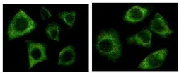 Anti-pan Cytokeratin antibody [7H8C4] used in Immunocytochemistry/ Immunofluorescence (ICC/IF). GTX83079
