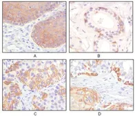 Anti-Cytokeratin 5 antibody [3E2F1] used in IHC (Paraffin sections) (IHC-P). GTX83080