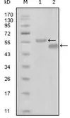 Anti-EphA6 antibody [3D5B10] used in Western Blot (WB). GTX83108