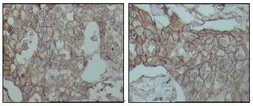 Anti-CD44 antibody [8E2F3] used in IHC (Paraffin sections) (IHC-P). GTX83114