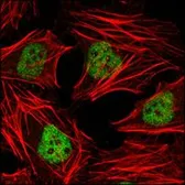 Anti-HDAC3 antibody [7G6C5] used in Immunocytochemistry/ Immunofluorescence (ICC/IF). GTX83173