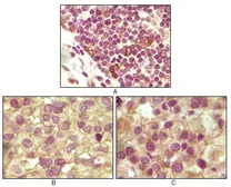 Anti-Inhibin alpha antibody [4A2] used in IHC (Paraffin sections) (IHC-P). GTX83223
