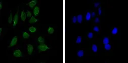 Anti-CHD3 antibody [2G4] used in Immunocytochemistry/ Immunofluorescence (ICC/IF). GTX83232