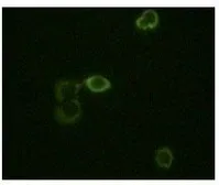 Anti-ABL2 antibody [1H1B11] used in Immunocytochemistry/ Immunofluorescence (ICC/IF). GTX83254