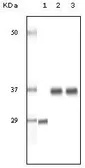 Anti-SRA antibody [1D4H8] used in Western Blot (WB). GTX83332