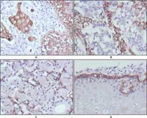 Anti-Cytokeratin 17 antibody [3B12] used in IHC (Paraffin sections) (IHC-P). GTX83366