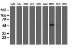 Anti-UHMK1 antibody [2H4] used in Western Blot (WB). GTX83438
