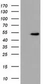 Anti-UHMK1 antibody [2D3] used in Western Blot (WB). GTX83439