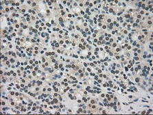 Anti-TRIB2 antibody [8D11] used in IHC (Paraffin sections) (IHC-P). GTX83495